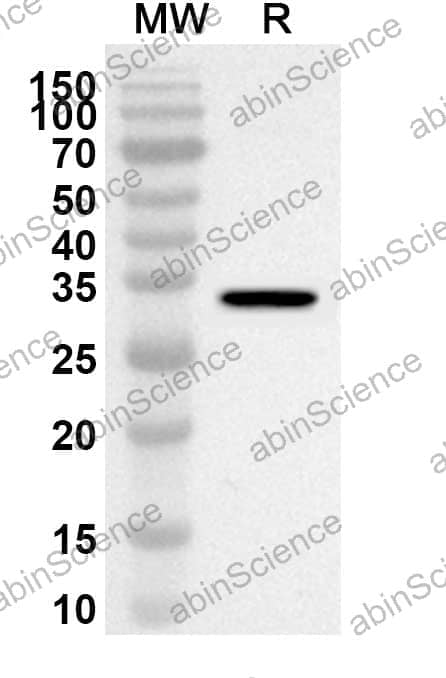 Anti-MAPRE1 Polyclonal Antibody