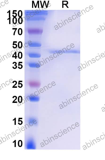 Recombinant Human TMPRSS2 Protein, C-His