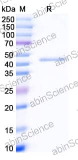 Recombinant Human TMPRSS2 Protein, N-His
