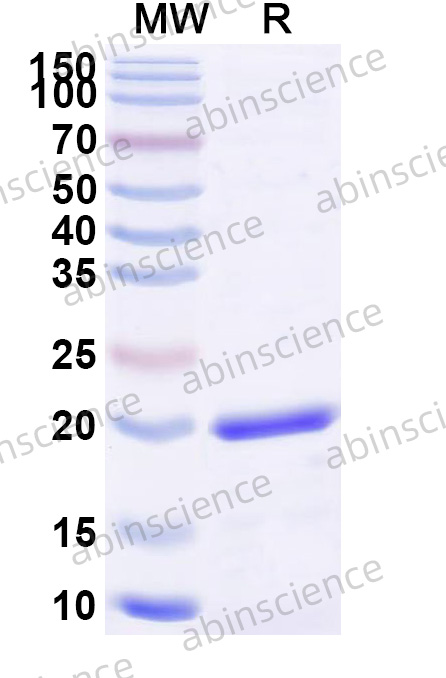 Recombinant Human NLRP3 Protein, N-His