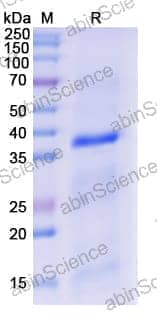 Recombinant Human TLR7 Protein, N-His
