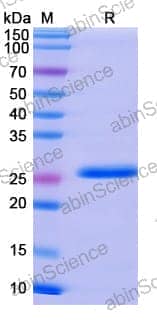 Recombinant Human GAD1/GAD67 Protein, N-His