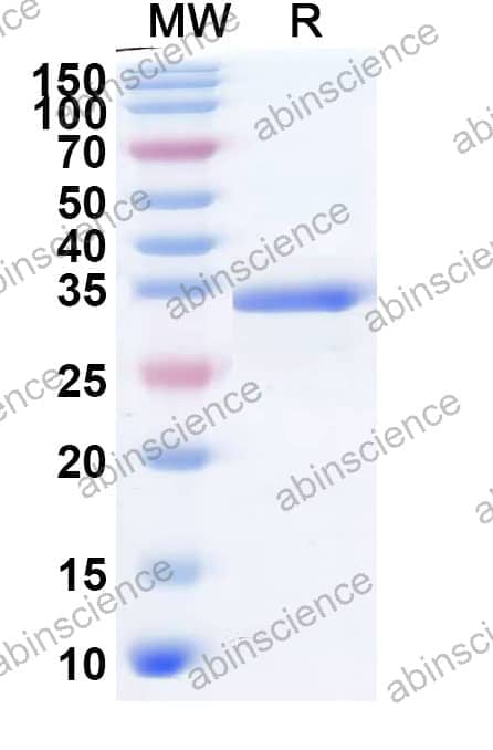 Recombinant Human UBAP2 Protein, N-GST & C-His
