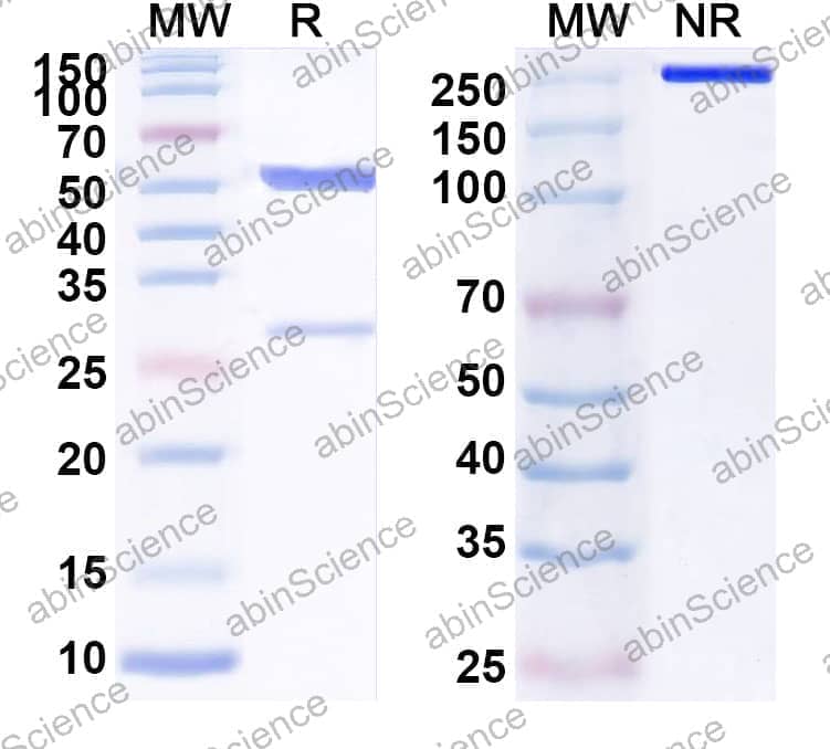 Anti-Human IL38/IL1F10 Recombinant Antibody (SAA1610)