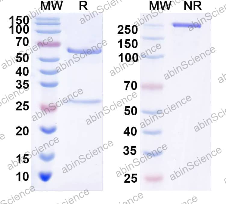 Anti-Human IL38/IL1F10 Recombinant Antibody (SAA2109)