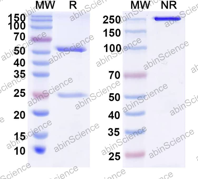 Anti-Human IL38/IL1F10 Recombinant Antibody (IMM20130)