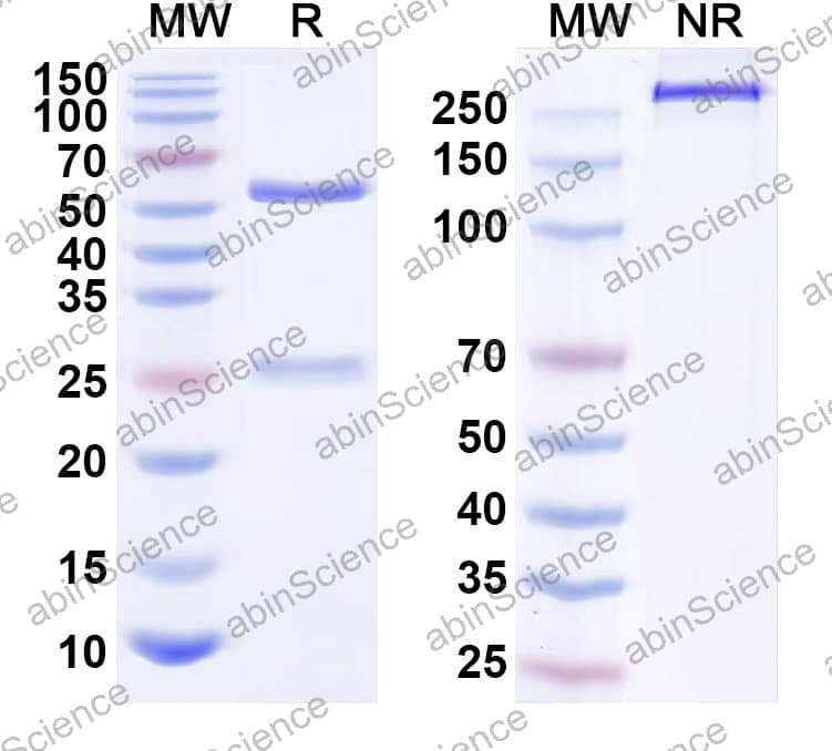 Anti-Human IL38/IL1F10 Antibody (SAA2514)