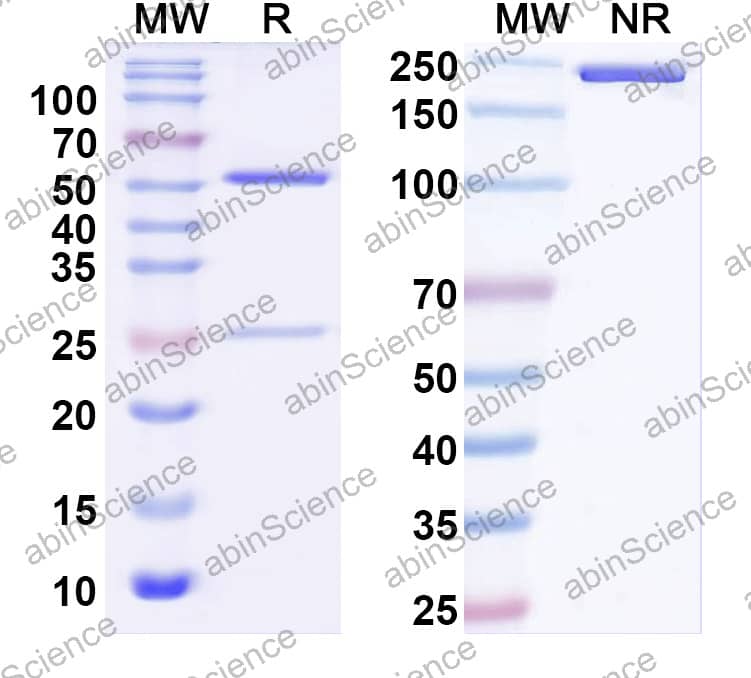 Anti-Human IL38/IL1F10 Antibody (SAA2515)