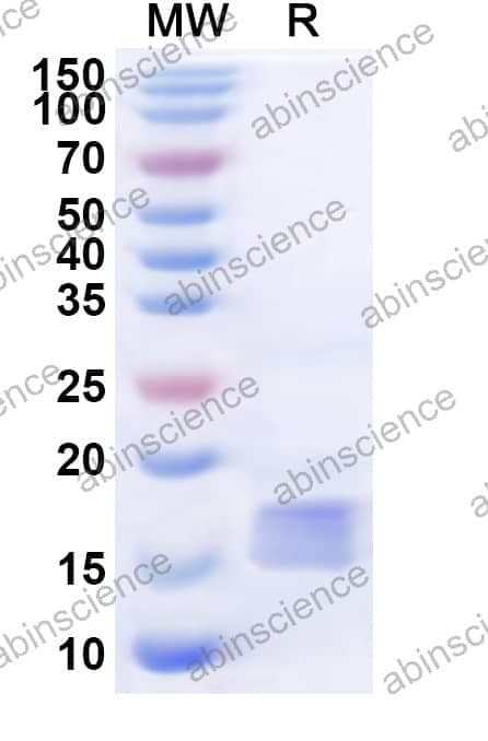 Recombinant Human BTLA Protein, N-His