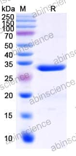Recombinant Human FOXP3 Protein, N-His-SUMO