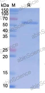 Recombinant Human CDX2 Protein, N-GST