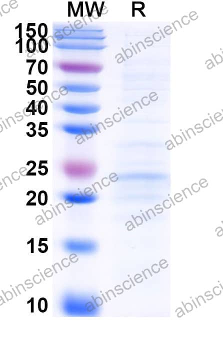 Recombinant Human IL23A Protein, C-His