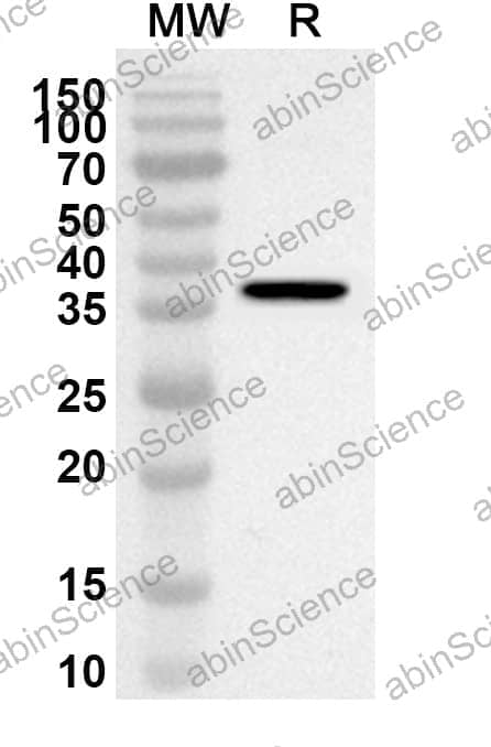 Anti-ESR2 Polyclonal Antibody