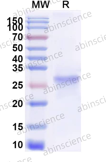 Recombinant Human SH2B3 Protein, N-His