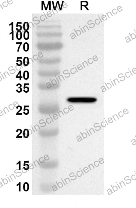 Anti-Human SH2B3 Polyclonal Antibody