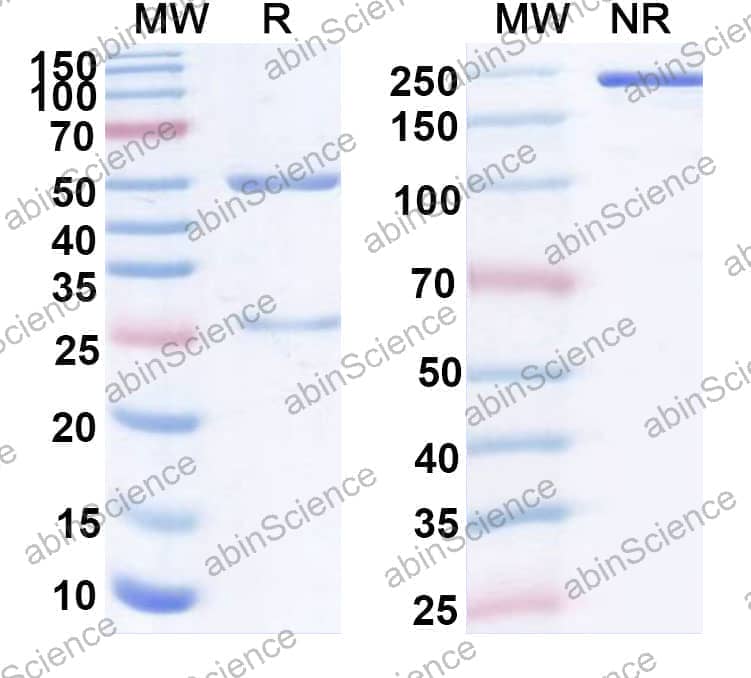 Anti-Human IL21 Antibody (SAA0390)