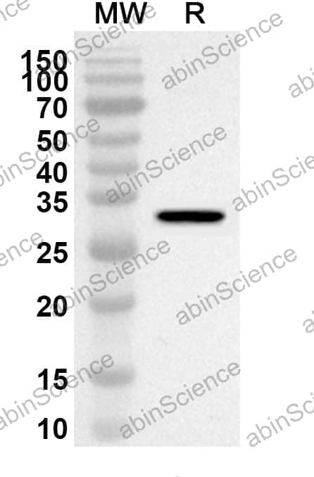 Anti-APPL1 Polyclonal Antibody
