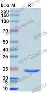Recombinant Human IRAK4 Protein, N-His