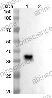 Research Grade Lesabelimab