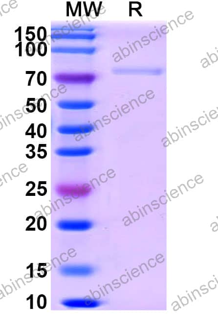 Recombinant Human NECTIN4/PVRL4 Protein, C-Fc