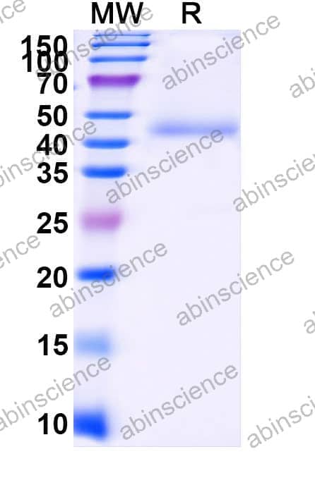 Recombinant Human NECTIN4/PVRL4 Protein, C-Fc