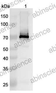 Anti-Human GPC3 Recombinant Antibody (YP7)
