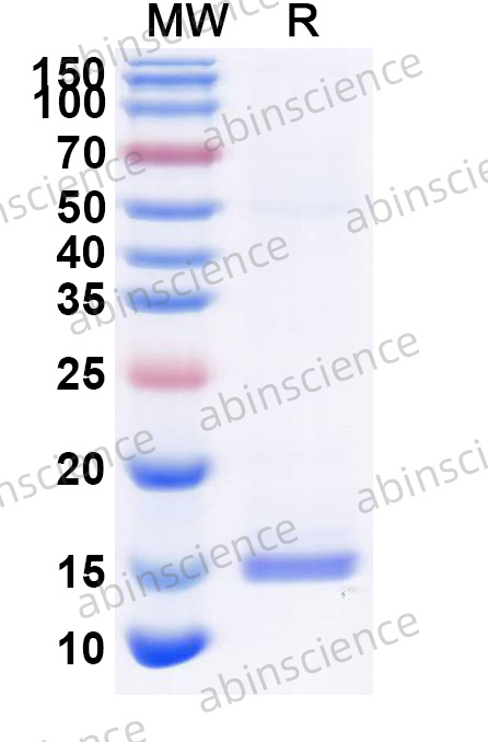 Anti-Human GPC3 Nanobody (HN3)