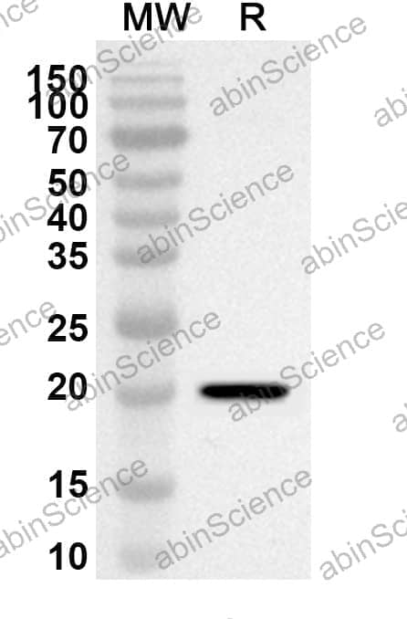 Anti-MECP2 Polyclonal Antibody