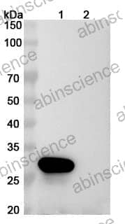 Mouse Anti-Human PMEL17/ME20M Antibody (17A9)