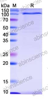 Recombinant Human NOTCH1 Protein, C-Fc