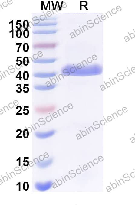 Anti-Human CD68/Macrosialin Antibody (SAA2569)
