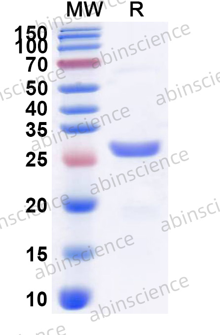 Recombinant Human PIK3CA Protein, N-His