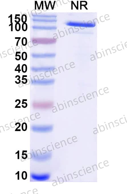 Anti-Human CD86/B7-2 Antibody (PMP2B10)