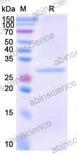 Recombinant Human CLDN18 Protein, C-His