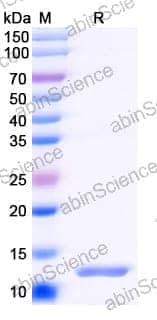 Recombinant Human CLDN18/Claudin-18 Protein, N-His