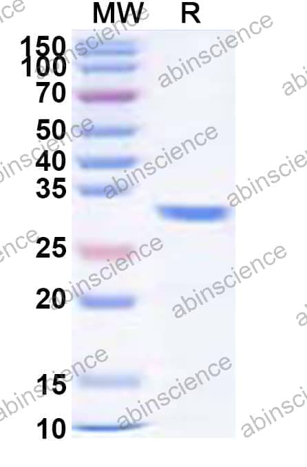 Recombinant Human CLDN18/Claudin-18 Protein, N-GST & C-His