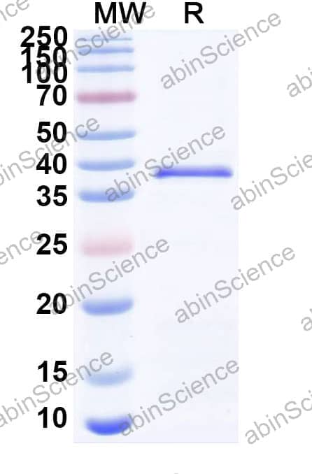 Recombinant Human CD184/CXCR4 Protein, N-GST & C-His