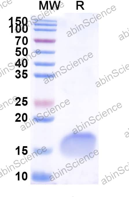 Anti-Human LYZ Nanobody (SAA1053)