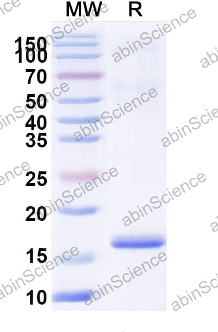 Anti-Human LYZ Nanobody (SAA1112)