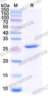 Recombinant Human MUC5AC Protein, N-His-SUMO