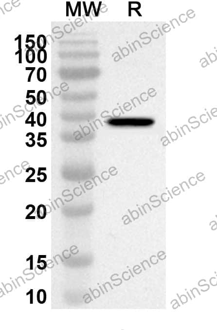 Anti-CDK6 Polyclonal Antibody
