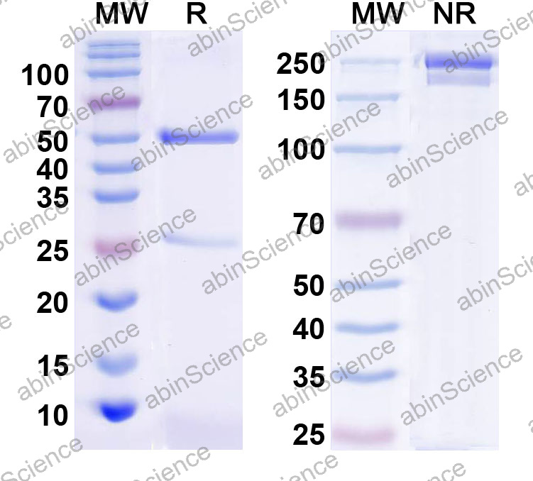 Anti-Human S100A10 Monoclonal Antibody (1A534)