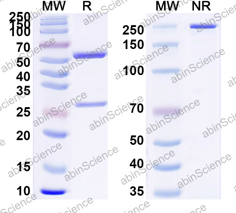Anti-Human S100A10 Monoclonal Antibody (1A535)