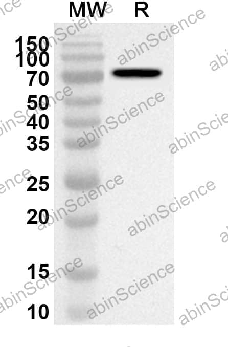 Anti-HSPA1A Polyclonal Antibody