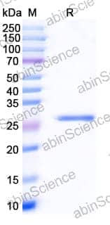 Recombinant Human TP53/p53 Protein, N-His