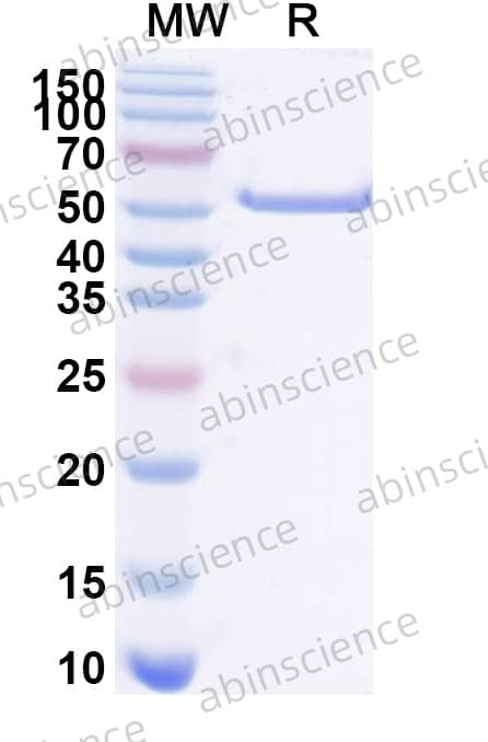 Recombinant Human TP53/p53 Protein, N-His
