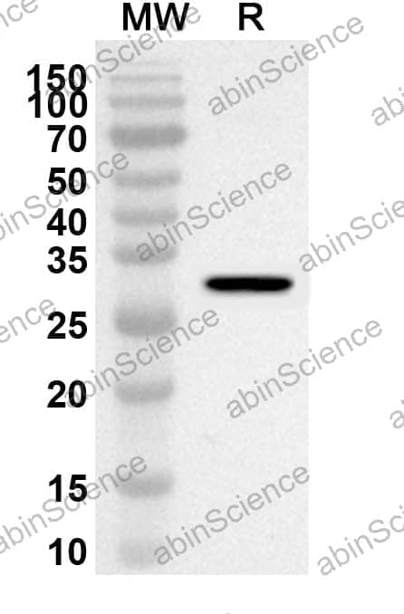 Anti-Human CYP2D6 Polyclonal Antibody