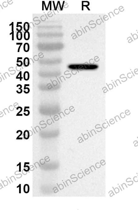 Anti-TOP2A Polyclonal Antibody