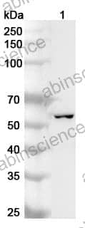 Anti-KRT7 Polyclonal Antibody