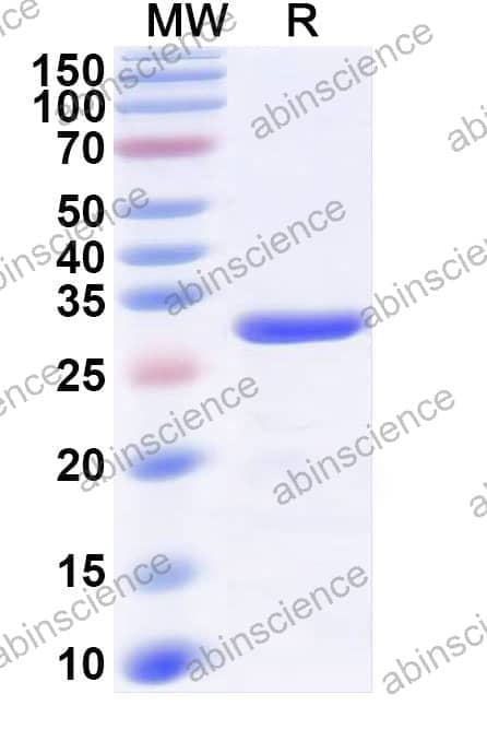 Recombinant Human FGF4 Protein, C-His